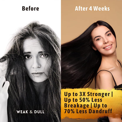 Before-and-after hair comparison after four weeks, noting up to 3x stronger, 50% less breakage, and 70% less dandruff