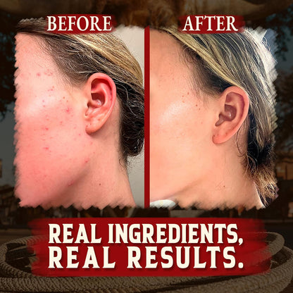 Wrath &amp; Remedy® Whipped Tallow &amp; Honey Balm
