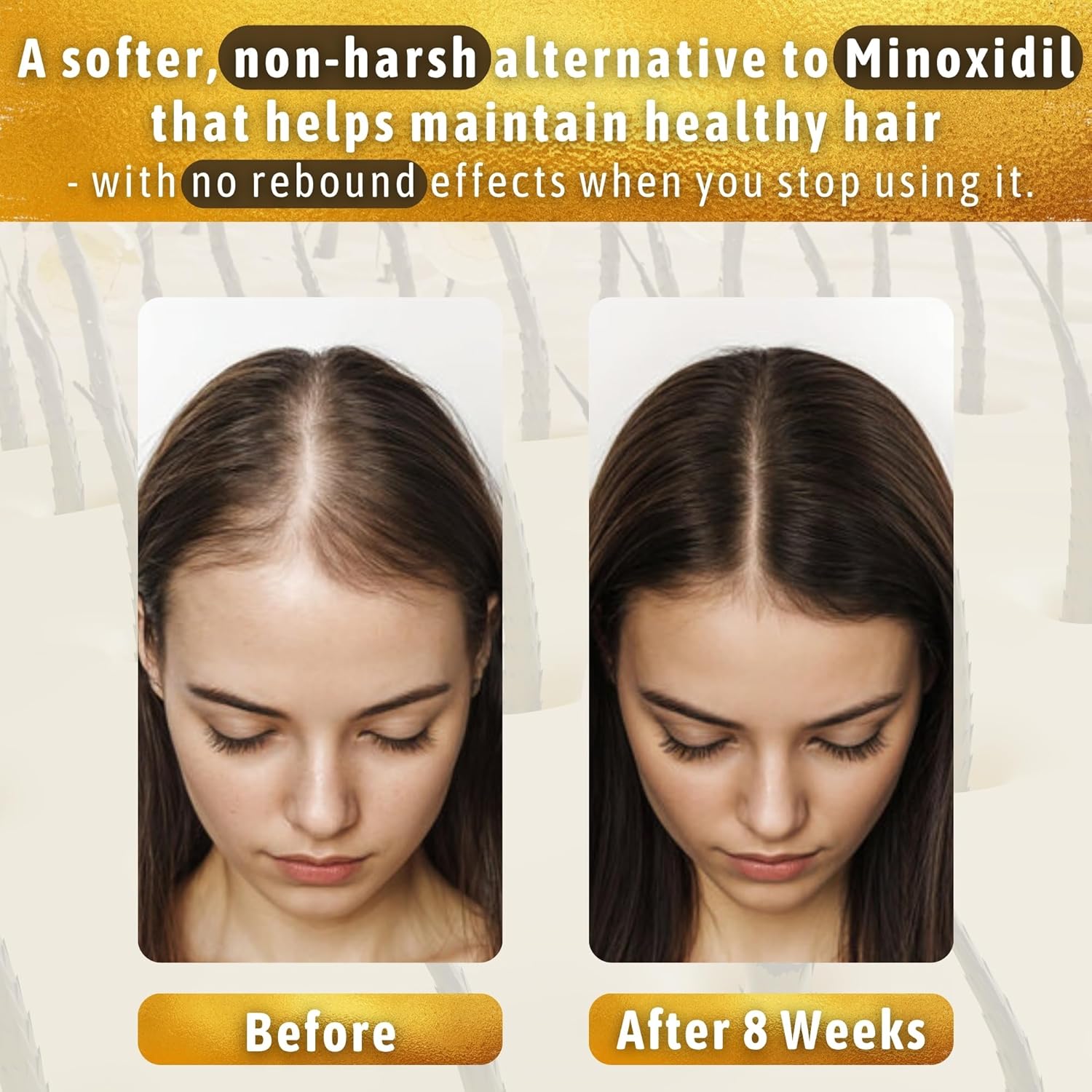 Before-and-after scalp photos after eight weeks, presenting the serum as a softer alternative to Minoxidil with no rebound