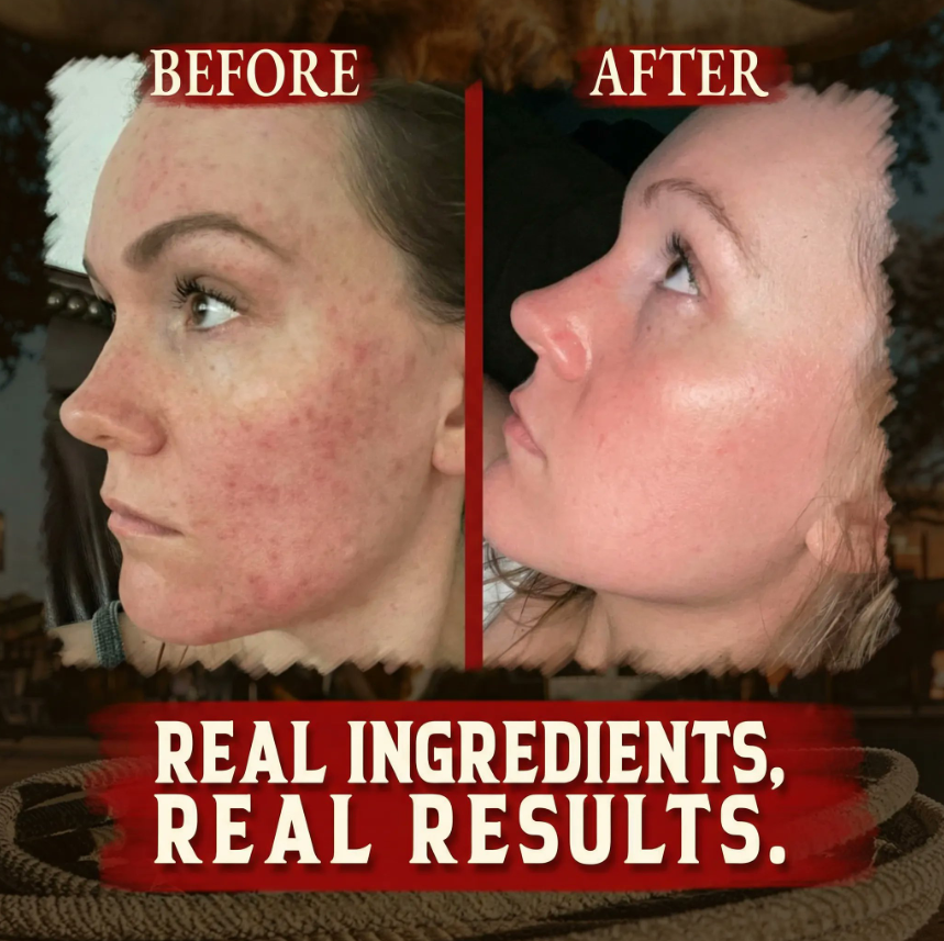 Wrath &amp; Remedy® Whipped Tallow &amp; Honey Balm